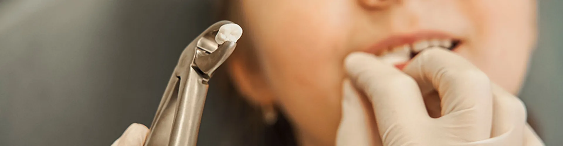 Dentist holding extracted tooth in forceps in front of child.