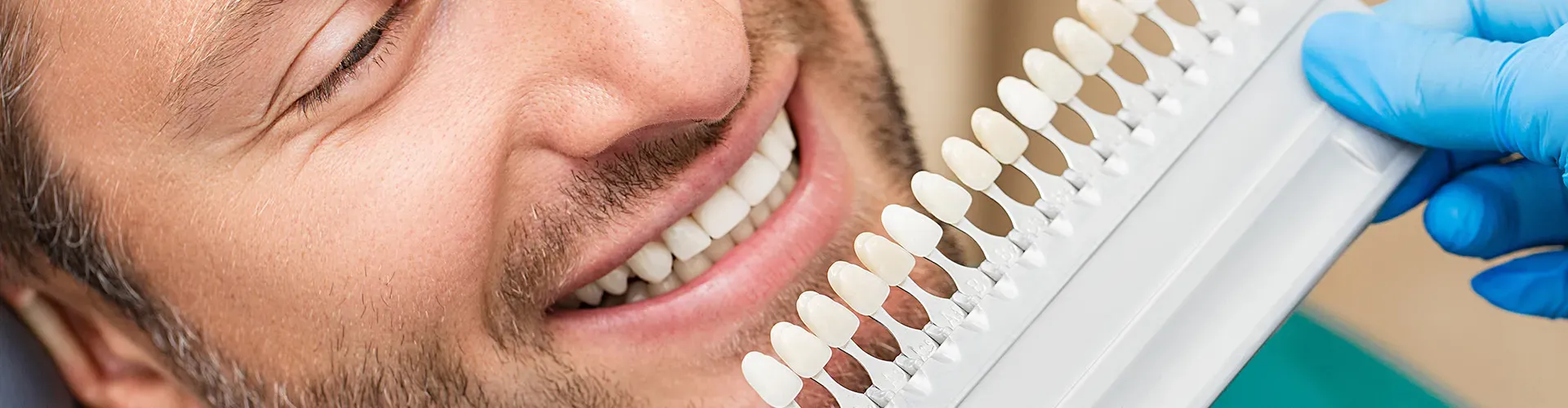 Dentist holding shade-matching tool against patient's teeth.