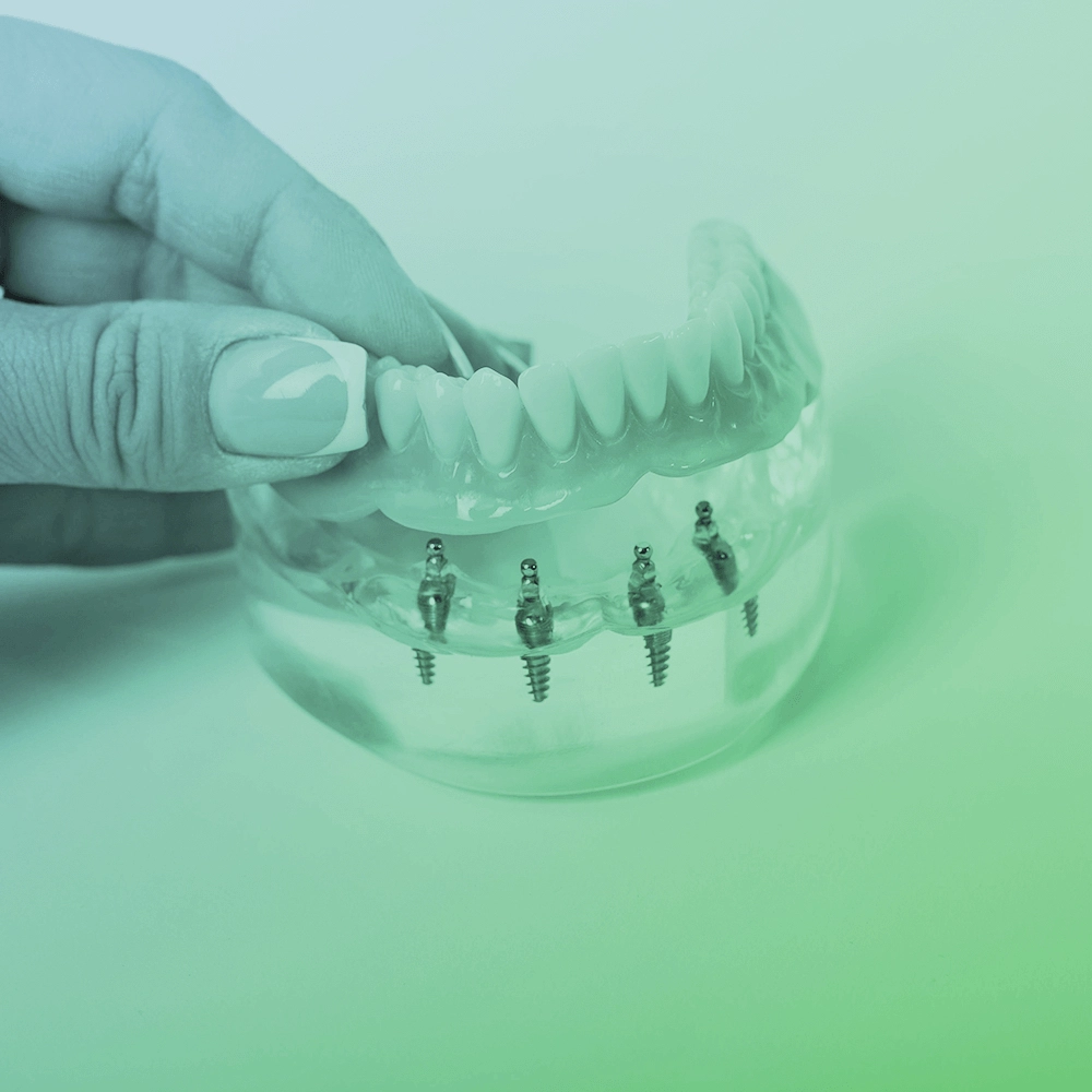 Dentures with all on 4.
