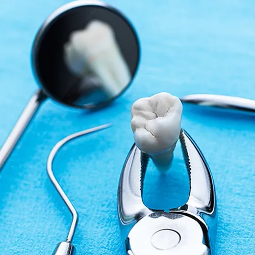 Tooth held in dental forceps with other dental tools.