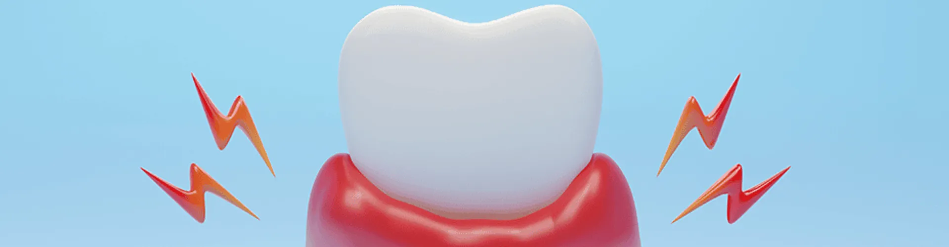Illustration of a tooth with irritated gums.